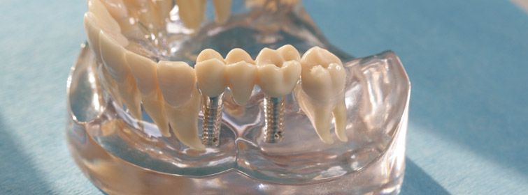Oralchirurgie